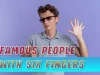 Famous People With Six Fingers
