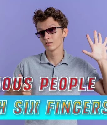 Famous People With Six Fingers