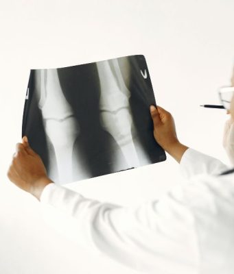 Should You See An Orthopedic Doctor For Back Pain