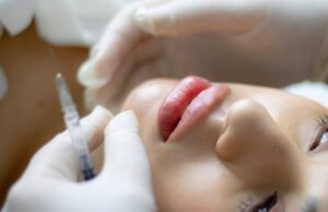 Common Mistakes To Avoid When Offering Dermal Filler Treatments