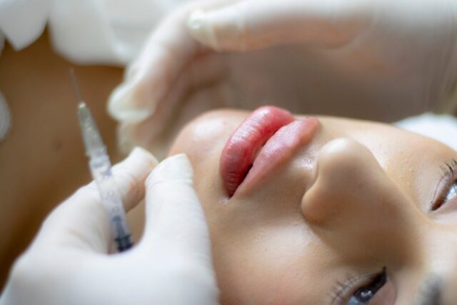 Common Mistakes To Avoid When Offering Dermal Filler Treatments