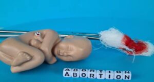 What is the Abortion Law in Michigan