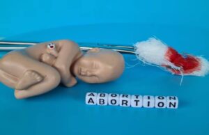 What is the Abortion Law in Michigan